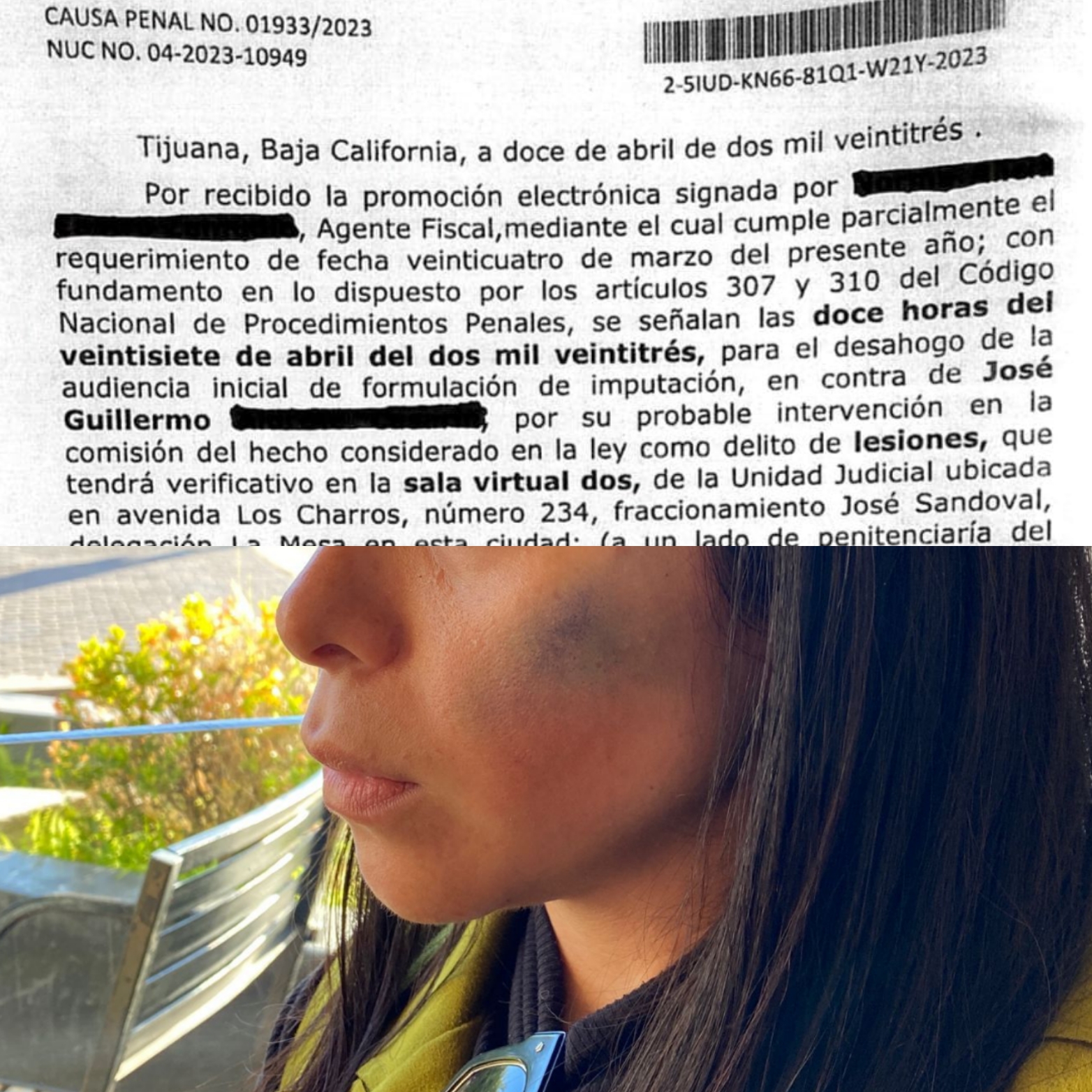 Denuncian por lesiones a una mujer al líder de burócratas de Tijuana
